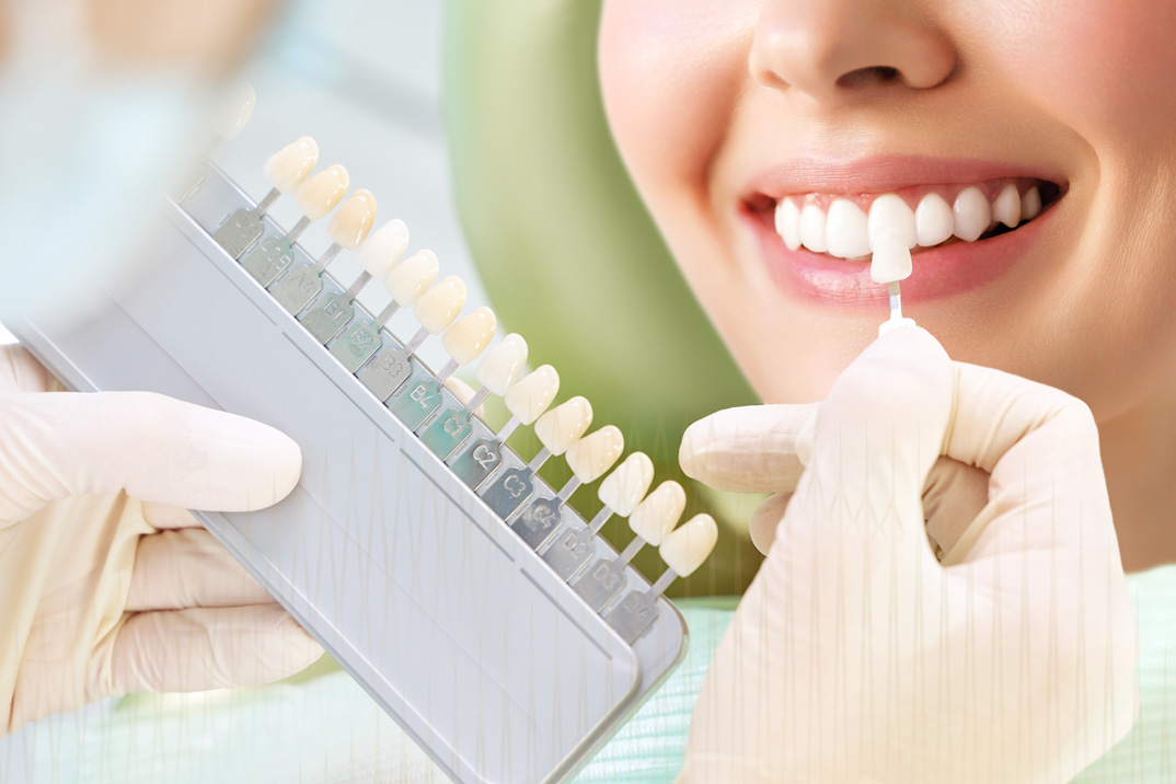 teeth whitening in Ballymena, Slemish Dental Care and Aesthetics